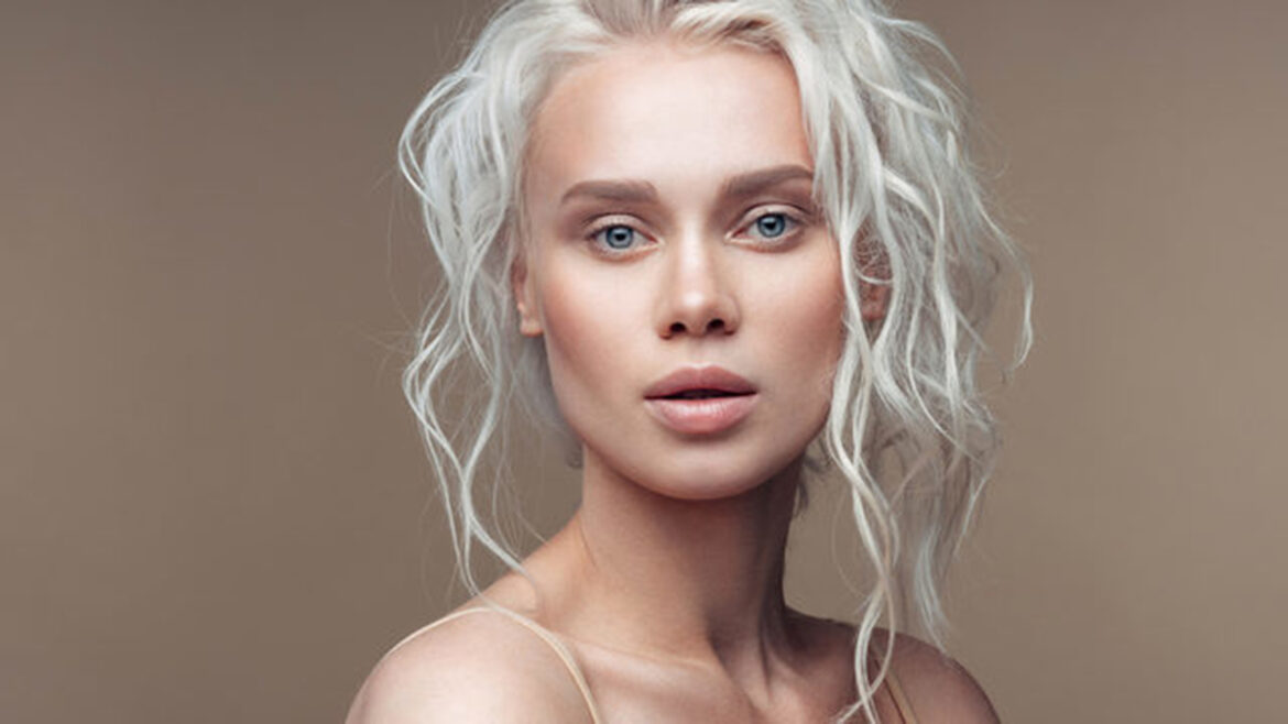 causes of white hair